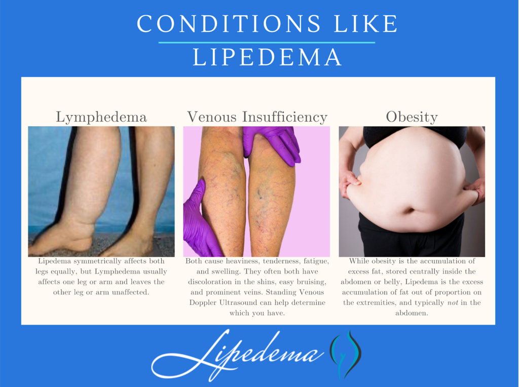 Infographic displaying Conditions Like Lipedema