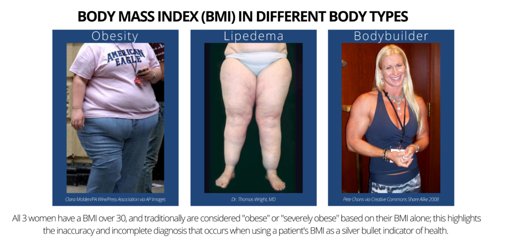 Medical infographics with illustrations of female body mass index