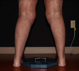 After Image: Calves