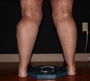 Before Image: Calves