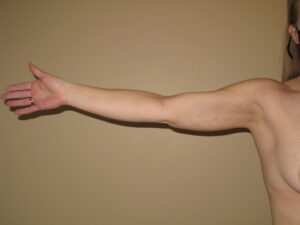 After Image: Stage 1