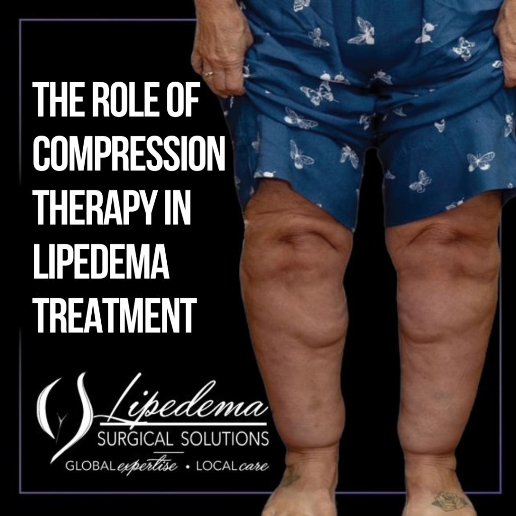 the role of compression therapy in lipedema treatment