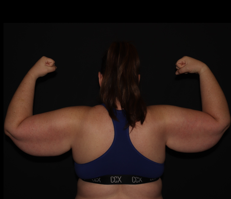 Before Image: Stage 3 - back