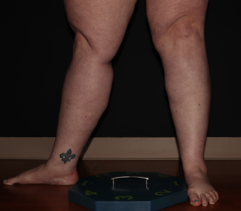 After Image: Stage 3 - left-front-oblique