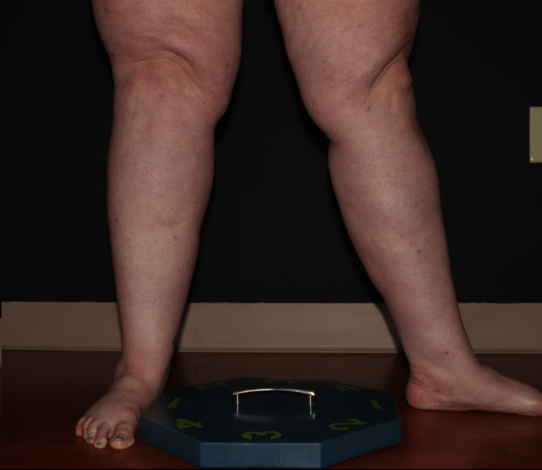 After Image: Stage 3 - right-front-oblique