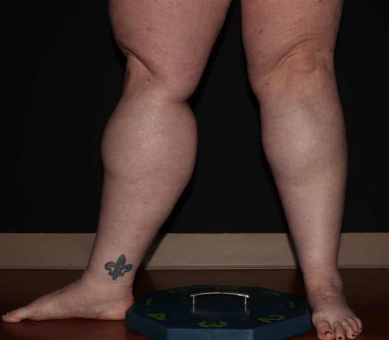 Before Image: Stage 3 - left-front-oblique