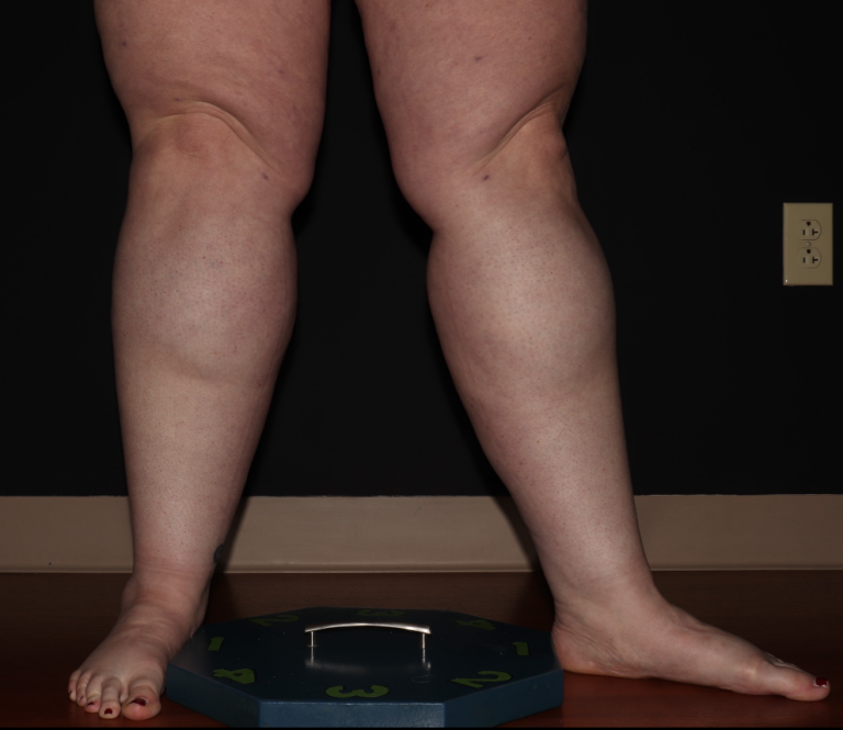 Before Image: Stage 3 - right-front-oblique