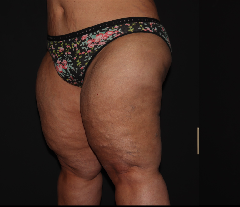 Before Image: Stage 3 - left-front-oblique