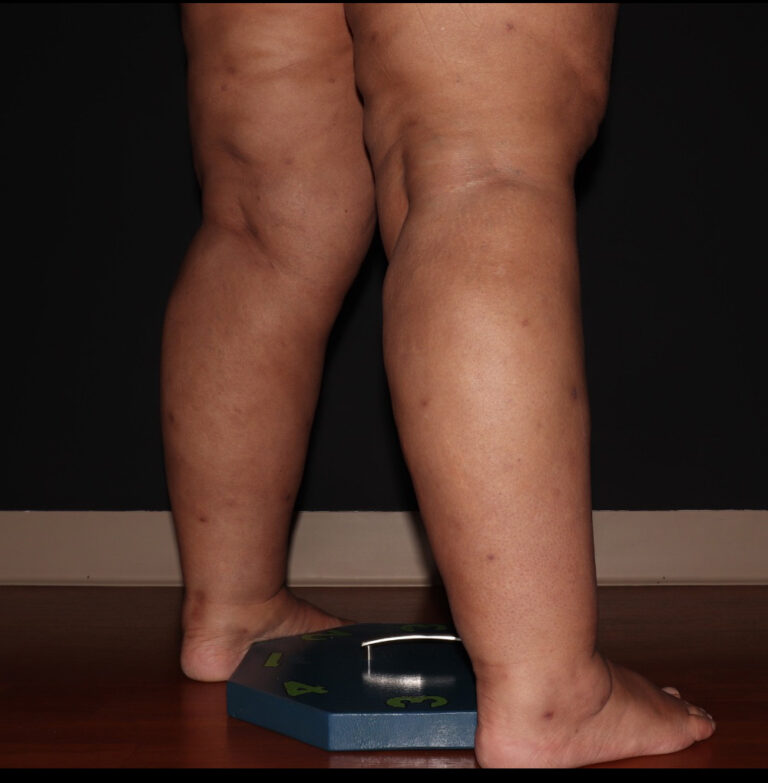 After Image: Stage 3 - right-back-oblique