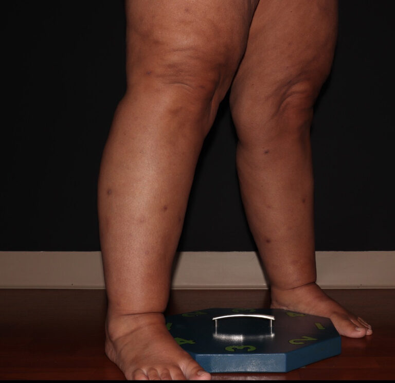 After Image: Stage 3 - right-front-oblique