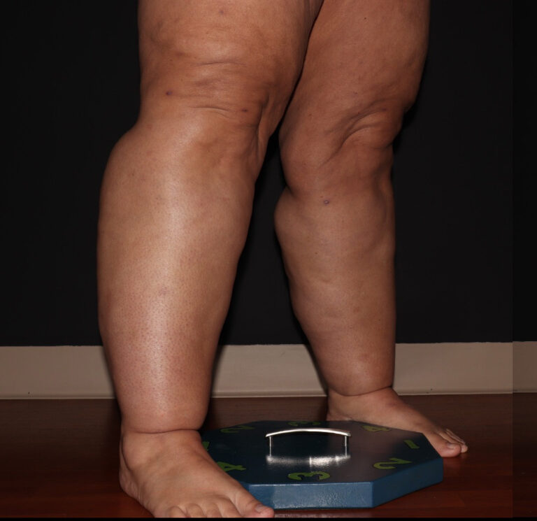 Before Image: Stage 3 - right-front-oblique