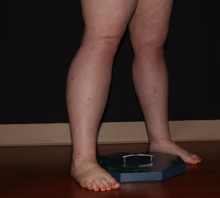After Image: Stage 2 - right-front-oblique