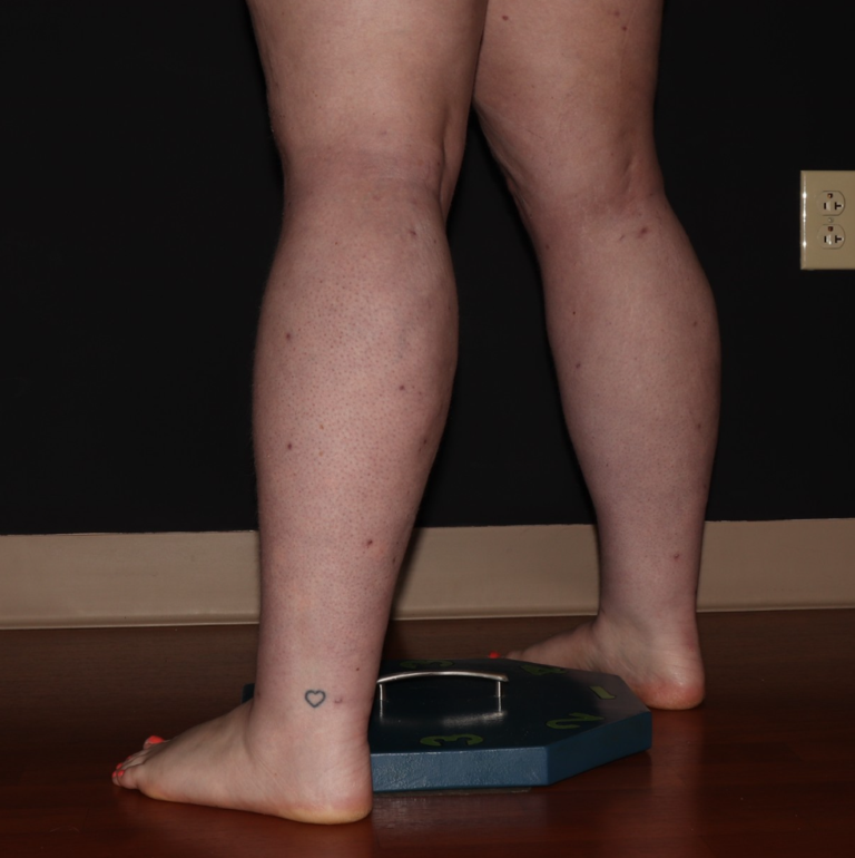 After Image: Stage 2 - left-back-oblique