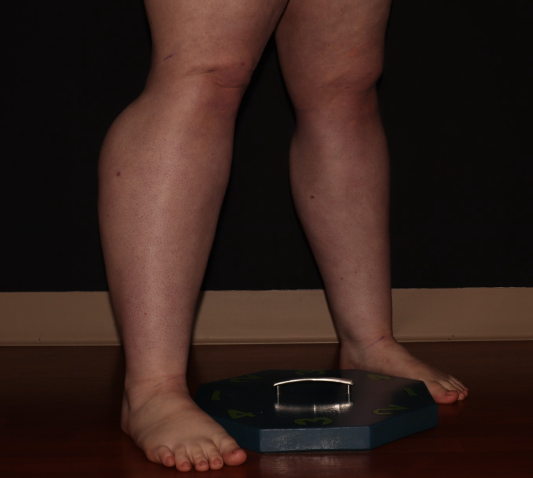 Before Image: Stage 2 - right-front-oblique