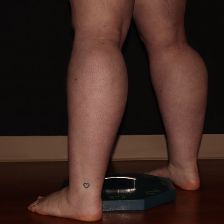 Before Image: Stage 2 - left-back-oblique