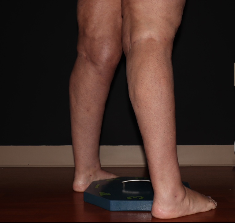 After Image: Stage 2 - right-back-oblique