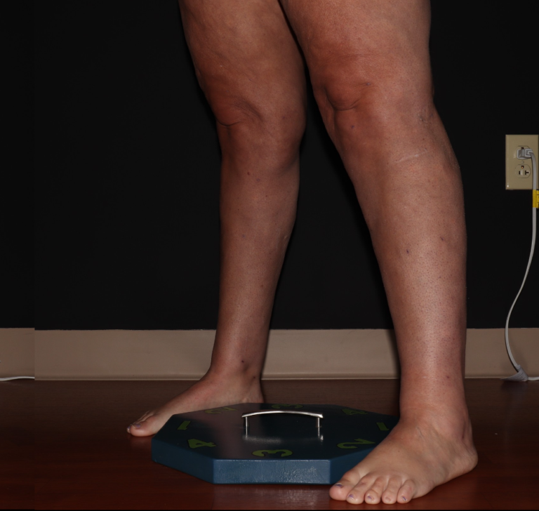 After Image: Stage 2 - left-front-oblique