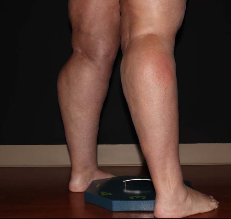 Before Image: Stage 2 - right-back-oblique