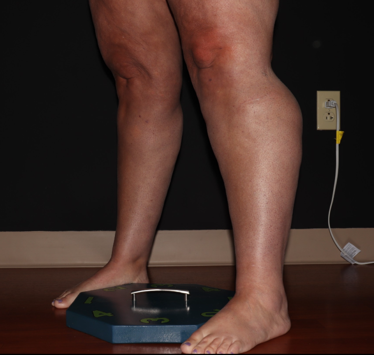 Before Image: Stage 2 - left-front-oblique