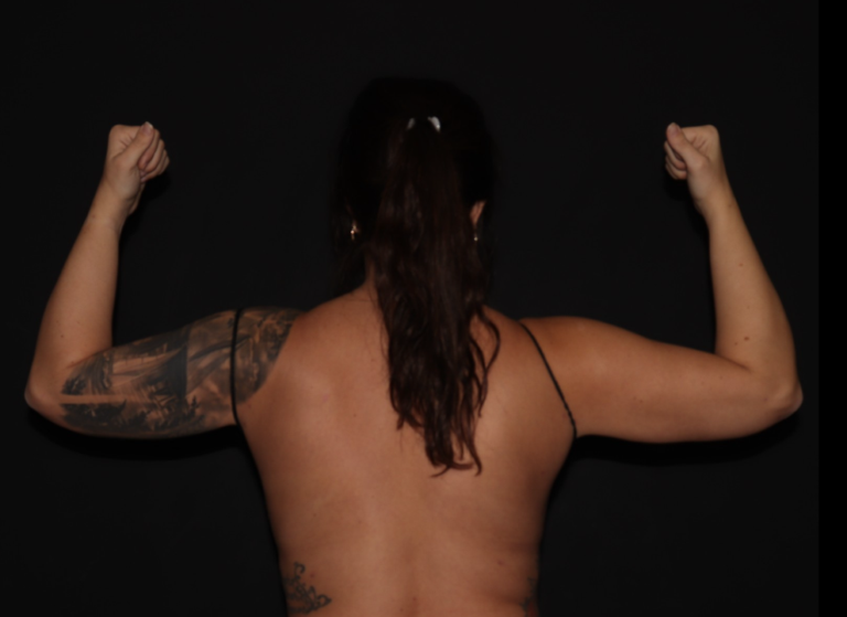 After Image: Stage 1 - back