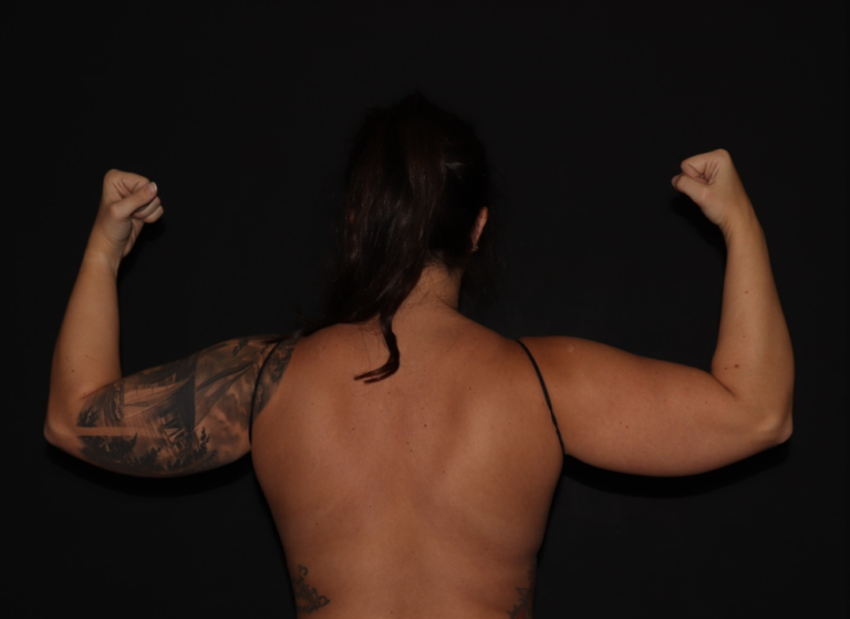 Before Image: Stage 1 - back