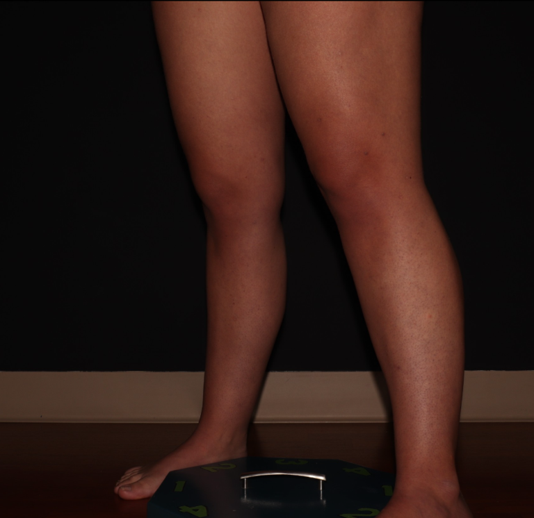 After Image: Stage 1 - left-front-oblique