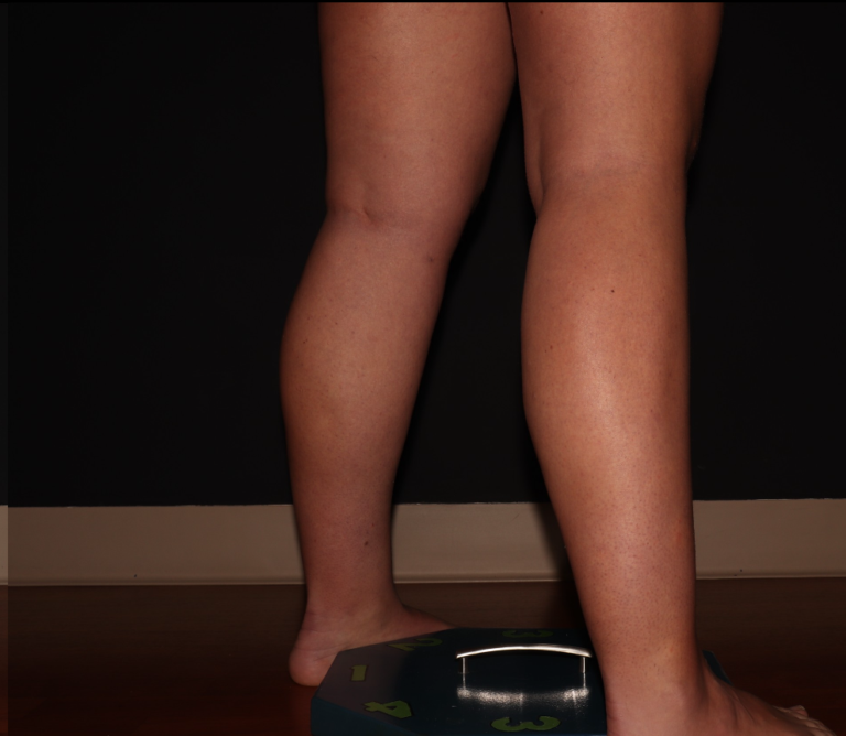 After Image: Stage 1 - right-back-oblique