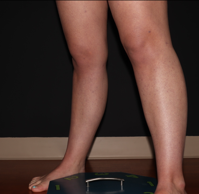 Before Image: Stage 1 - left-front-oblique