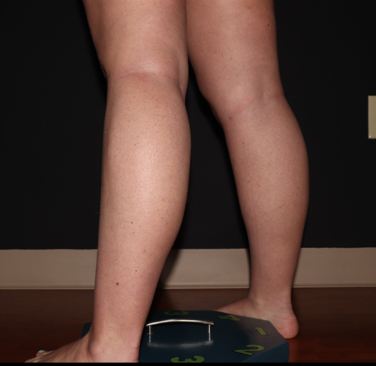 Before Image: Stage 1 - left-back-oblique