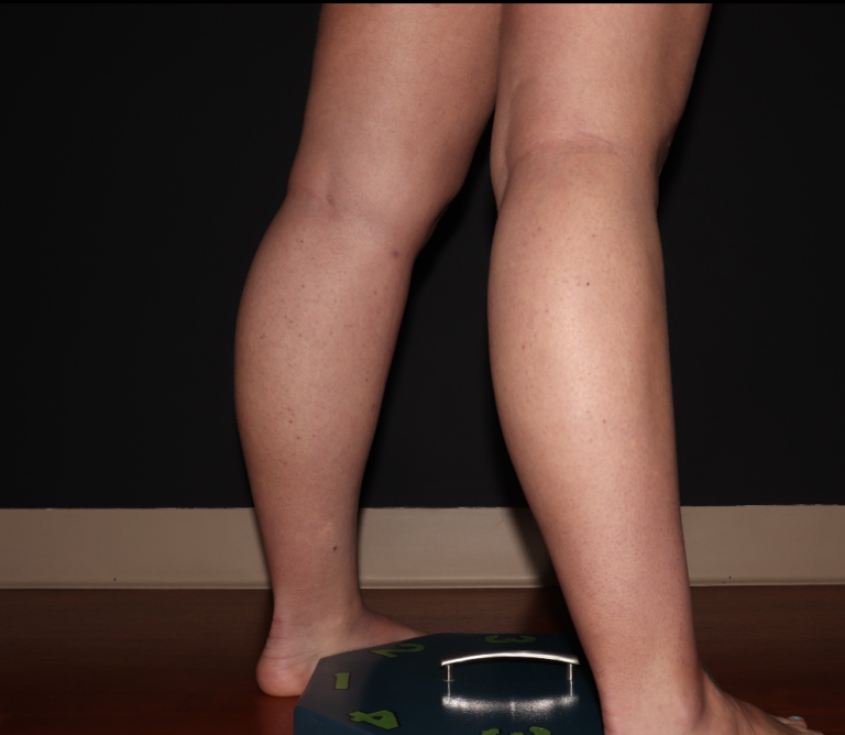 Before Image: Stage 1 - right-back-oblique