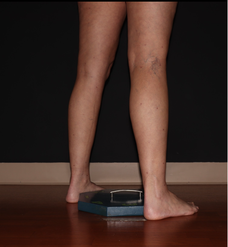 After Image: Stage 1 - right-back-oblique