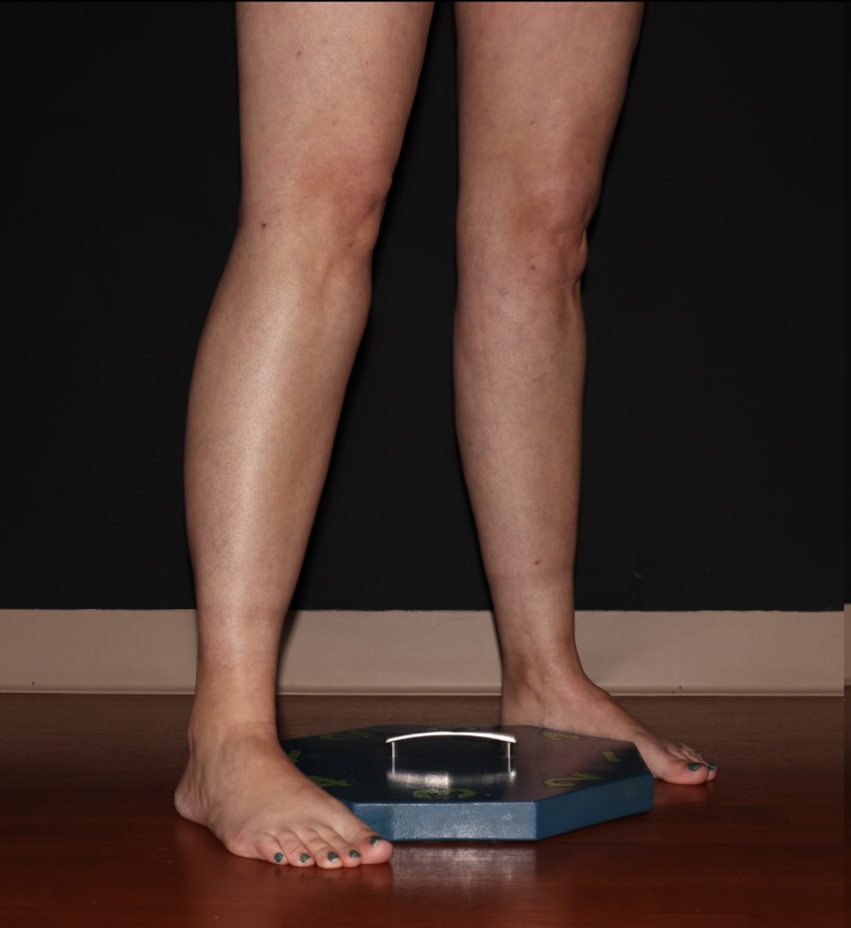 Before Image: Stage 1 - right-front-oblique
