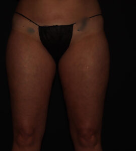 Before Image: Stage 1