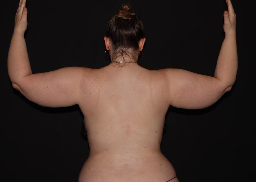 Before Image: Stage 2 - back