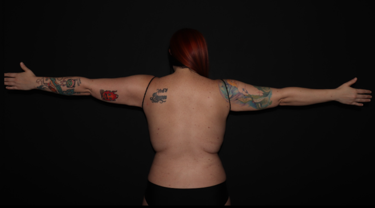 After Image: Stage 2 - back