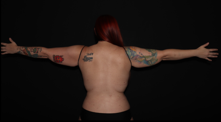 Before Image: Stage 2 - back