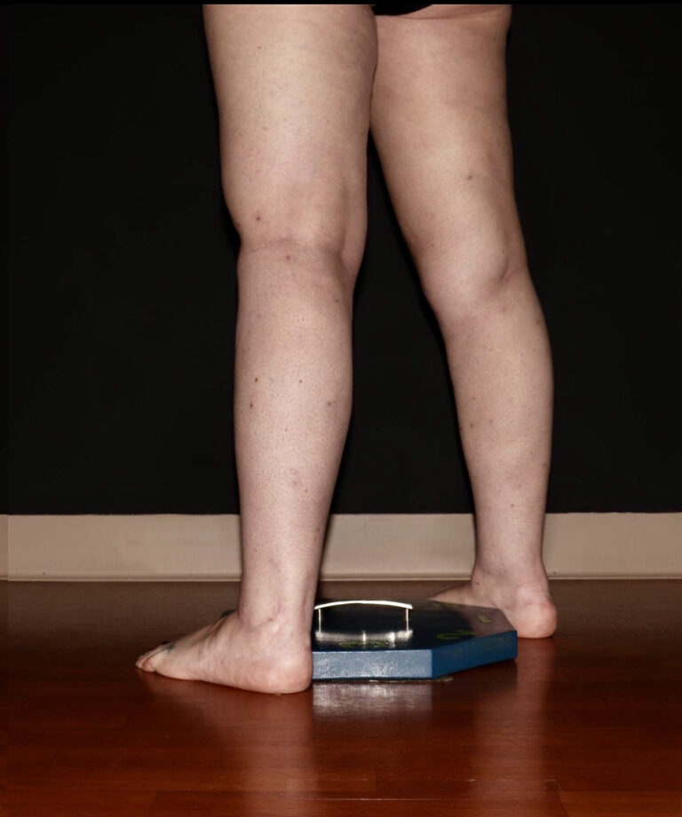 After Image: Stage 2 - left-back-oblique