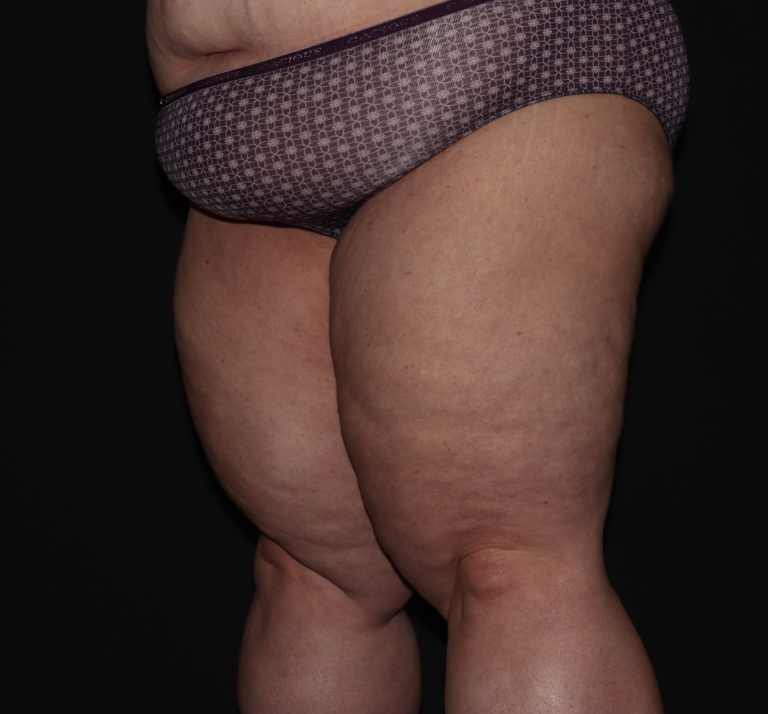 Before Image: Stage 3 - left-front-oblique