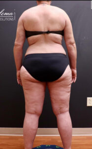 After Image: Full Body