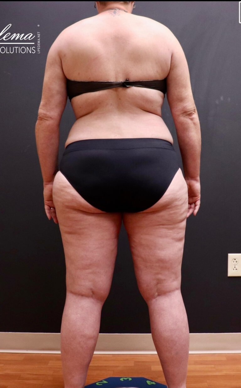 After Image: Full Body - back