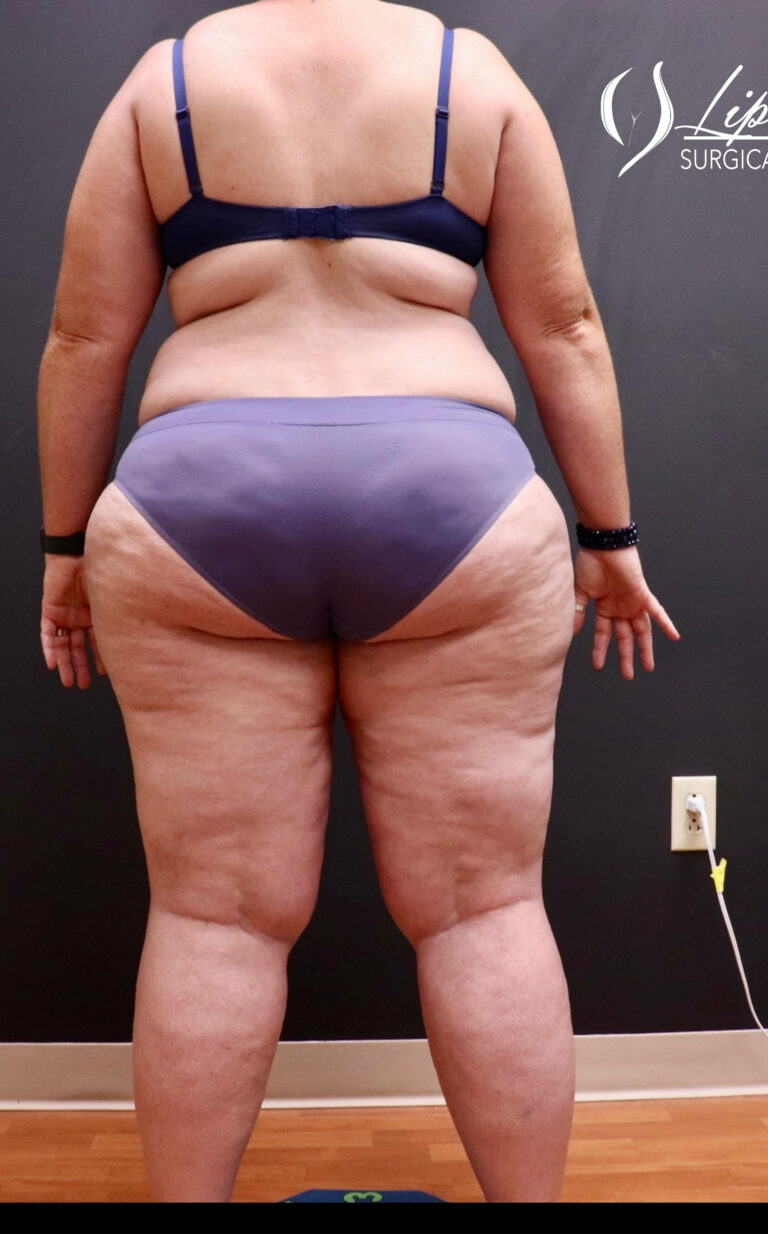 Before Image: Full Body - back