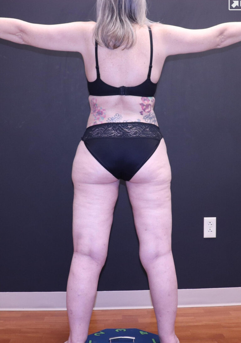 After Image: Full Body - back