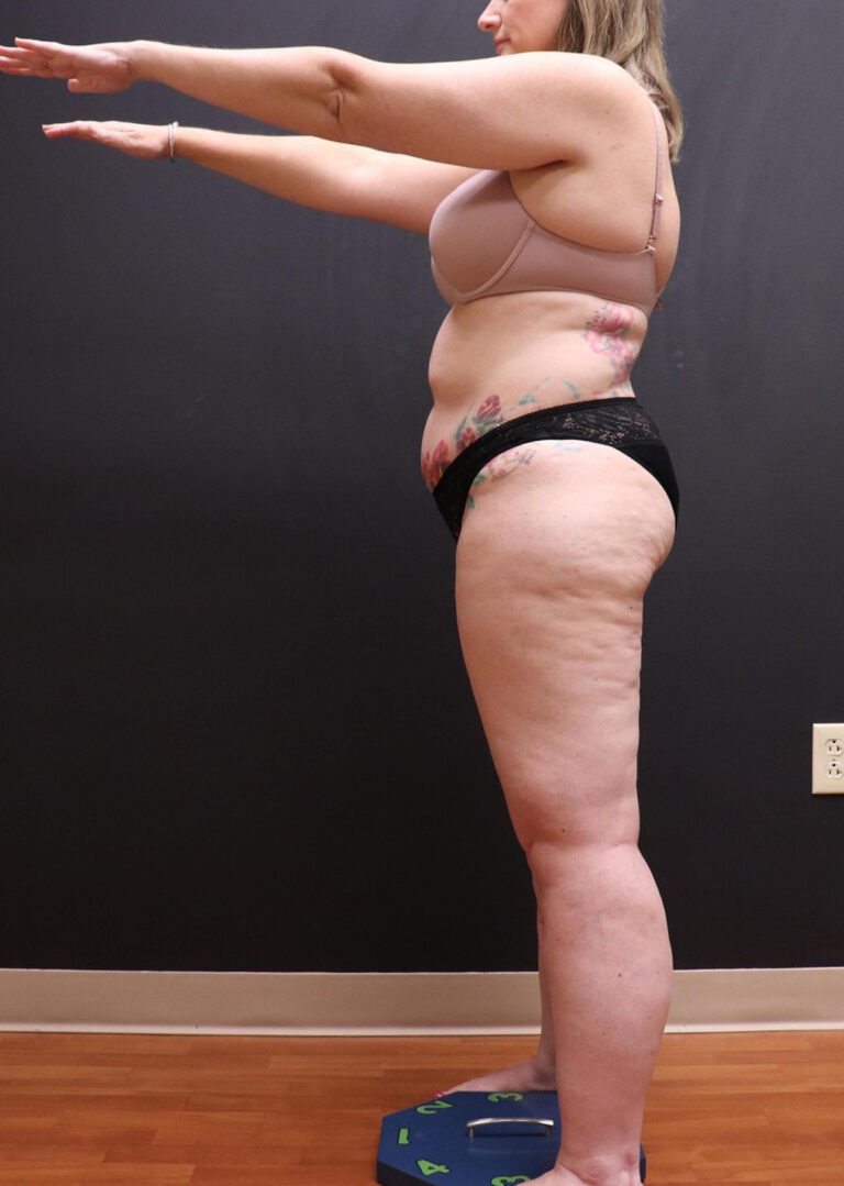 Before Image: Full Body - left-side