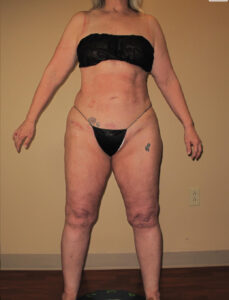 After Image: Full Body