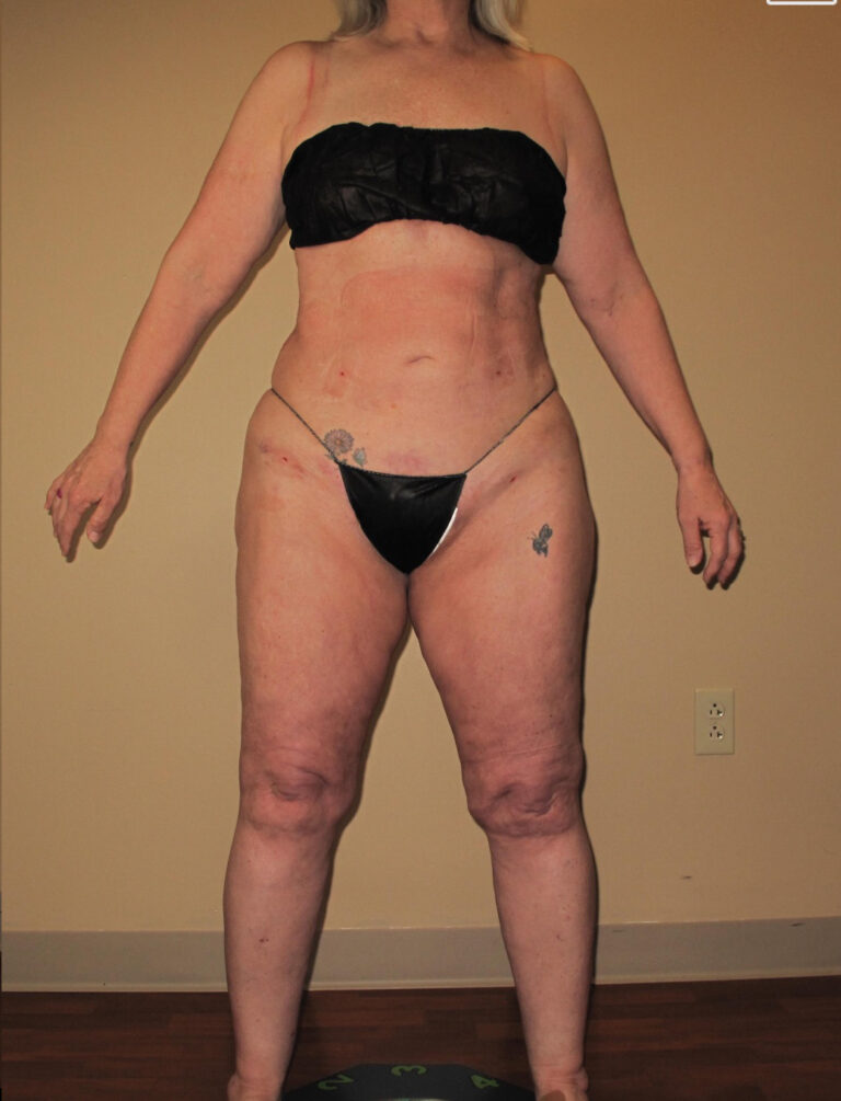 After Image: Full Body - front