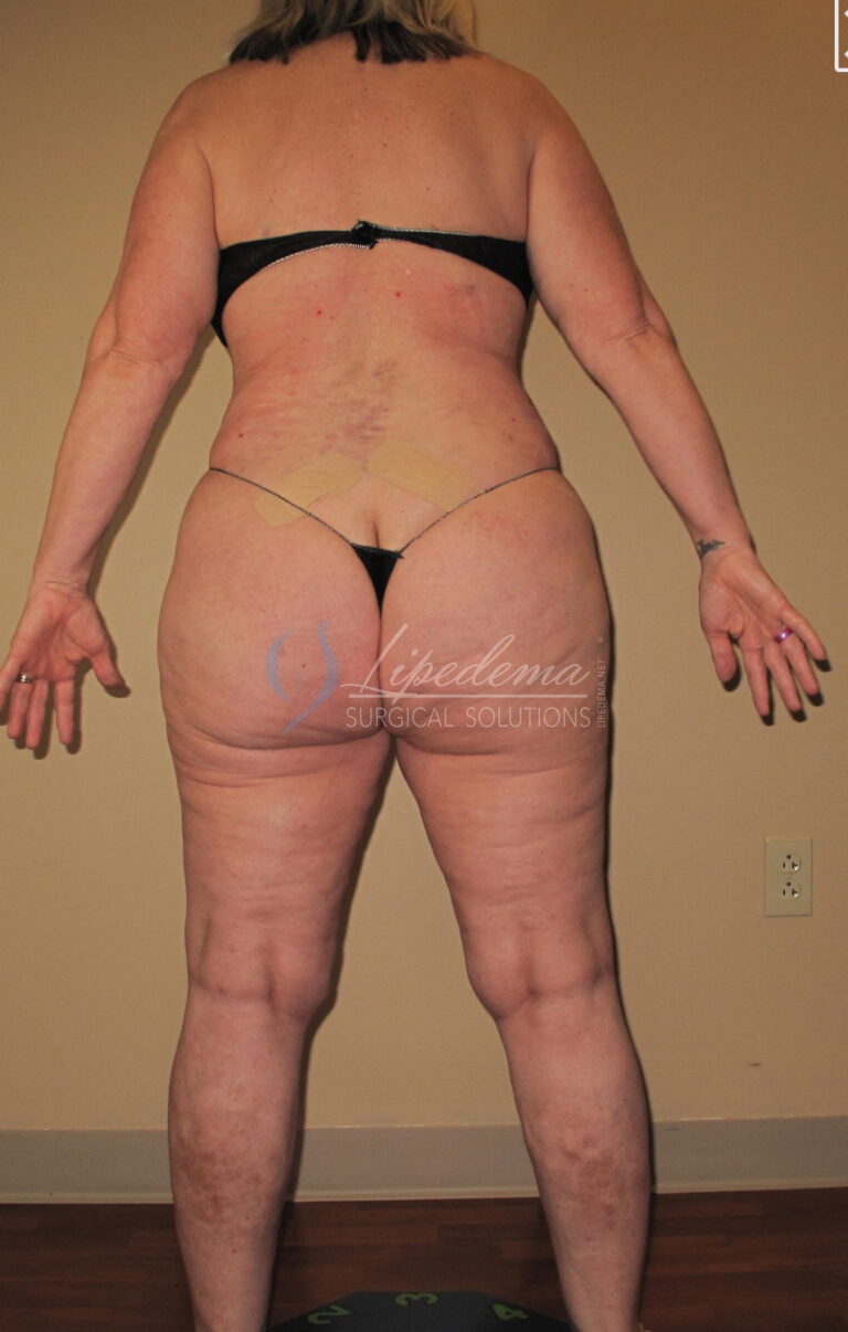 After Image: Full Body - back