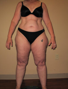 Before Image: Full Body