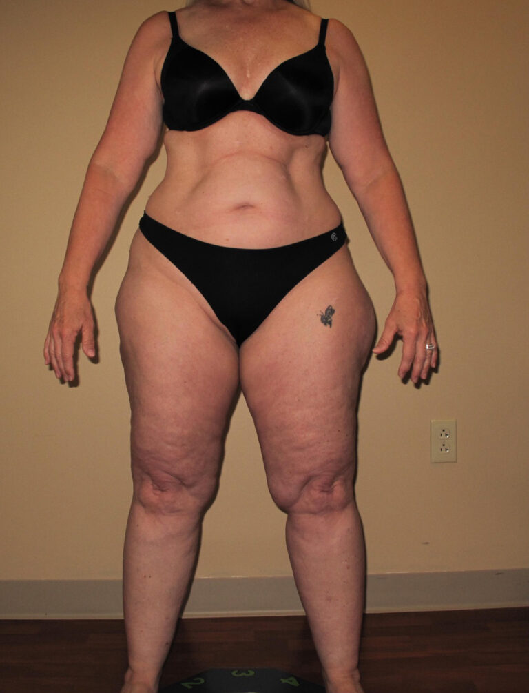 Before Image: Full Body - front