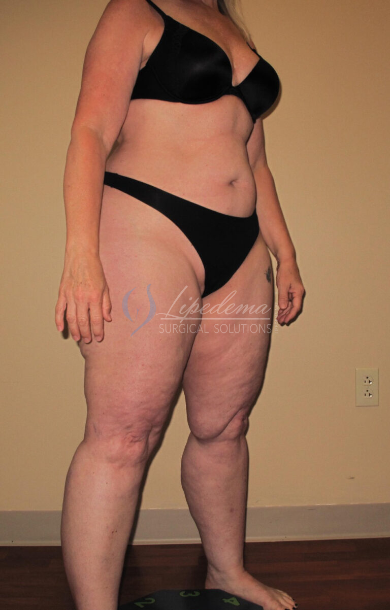 Before Image: Full Body - right-front-oblique