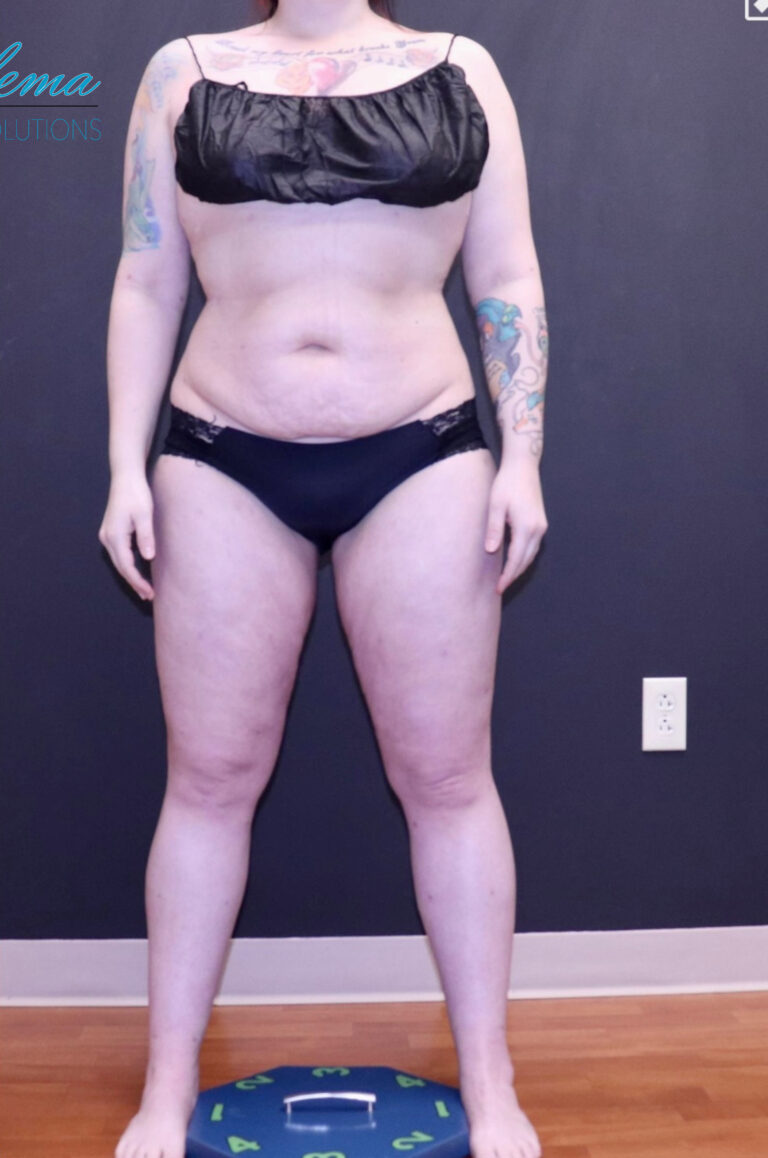 After Image: Full Body - front